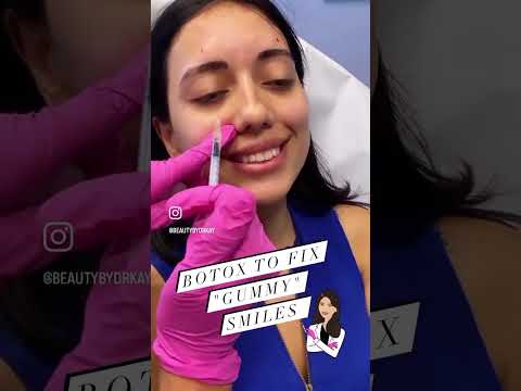 💋😄 „GUMMIFARBENES“ LÄCHELN-BOTOX 😄💋