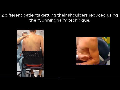 Straight to the point. Cunningham technique