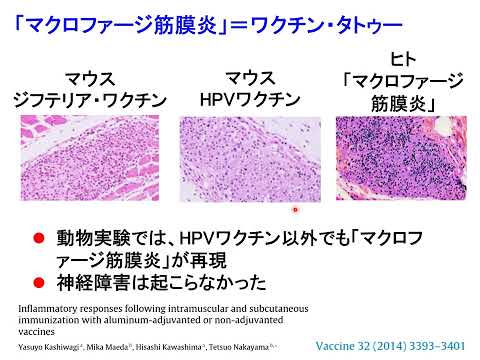 免疫学的アジュバント - 定義