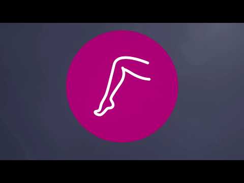 SONOVEIN S Echotherapie für die nicht-invasive Behandlung von Krampfadern