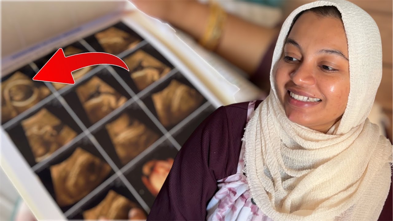 SCAN-ல BABY FACE..😍 My 5th Month SCAN Completed