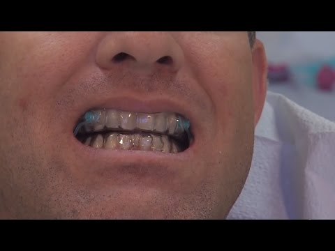 download lagu mp3 mp4 Silent Nite Reviews, download mp3 Silent Nite Reviews free downloadn, video klip Silent Nite Reviews