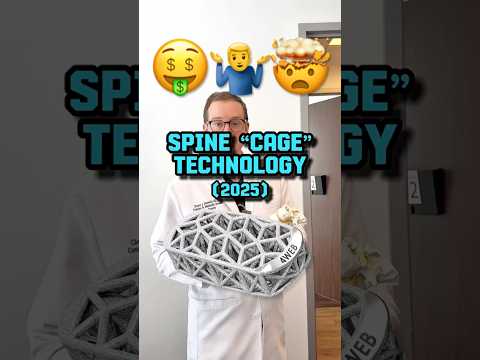 What’s New in Spine Cages: Dallas Surgeon’s Game-Changer!
