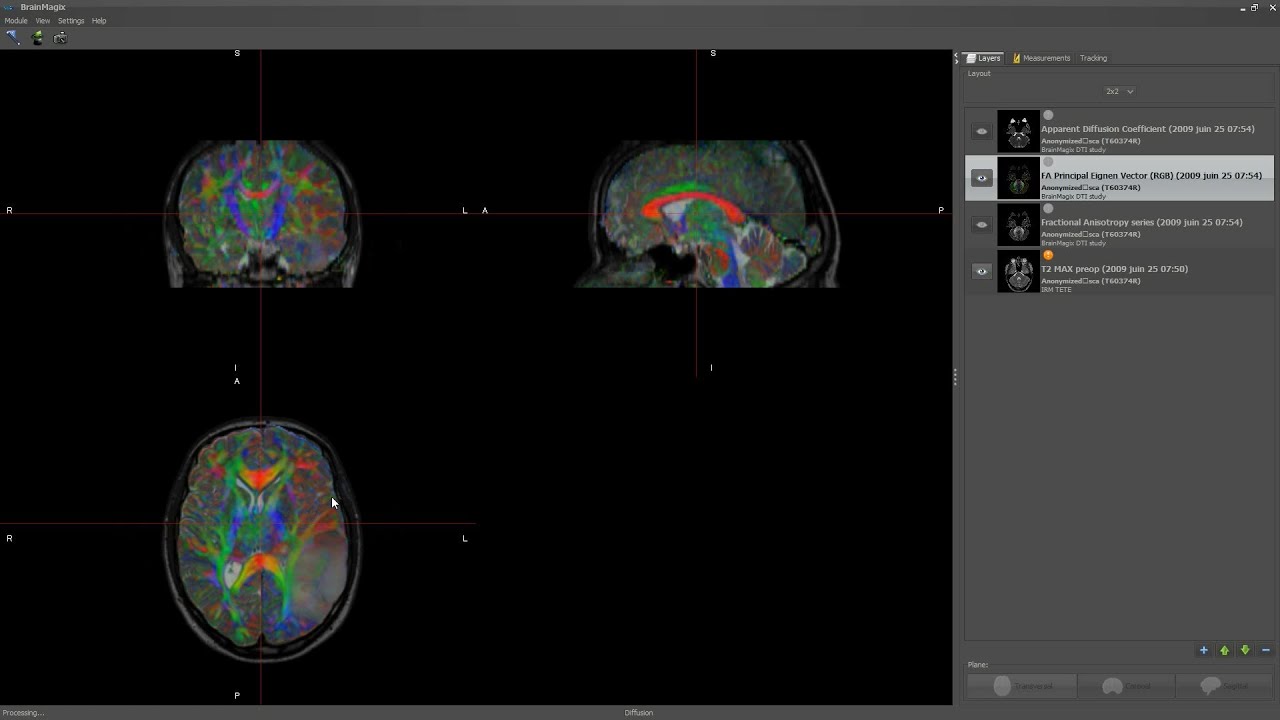 BrainMagix Diffusion Module