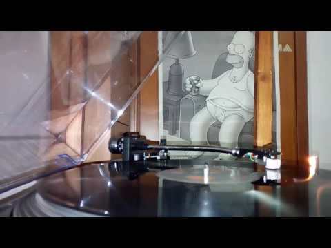 Moa Anbessa – Dub Version – B2