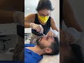 Nosethreadlift   Nosefiller Ameliyatsız burun estetiği