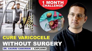 Download lagu Varicocele natural treatment | Varicocele treatment without any surgery | Dr. Gaurav Gangwani mp3 Download lagu Varicocele natural treatment | Varicocele treatment without any surgery | Dr. Gaurav Gangwani mp3