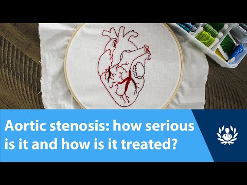 Aortic stenosis: how serious is it and how is it treated?