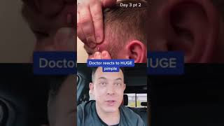 GIANT pimple turns into massive infection | 208SkinDoc