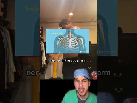 The result of a brachial plexus injury #Brachialplexus #Injury #NerveDamage #Nerve #atrophy#Dr#Nurse