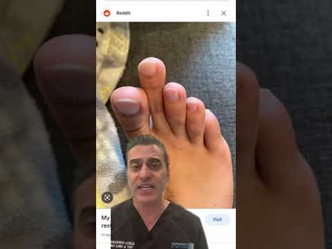Second Long Toe Facts!