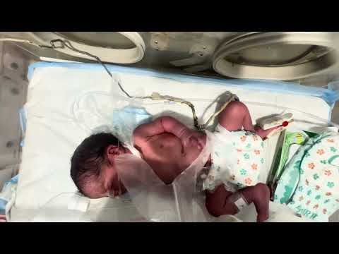 NICU Baby Care | Signs of Baby Distress and When to Change Pampers