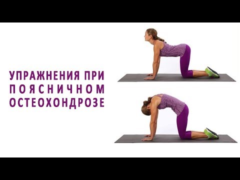Хирургическое лечение гонартроза коленного сустава Как пить корень лопуха при болях в суставах
