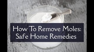 How To Remove Moles:  Safe Home Remedies