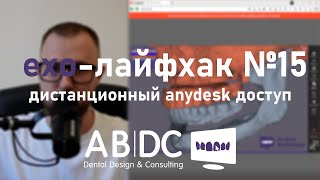 exo-лайфхак №15 - дистанционный anydesk доступ к #exocad