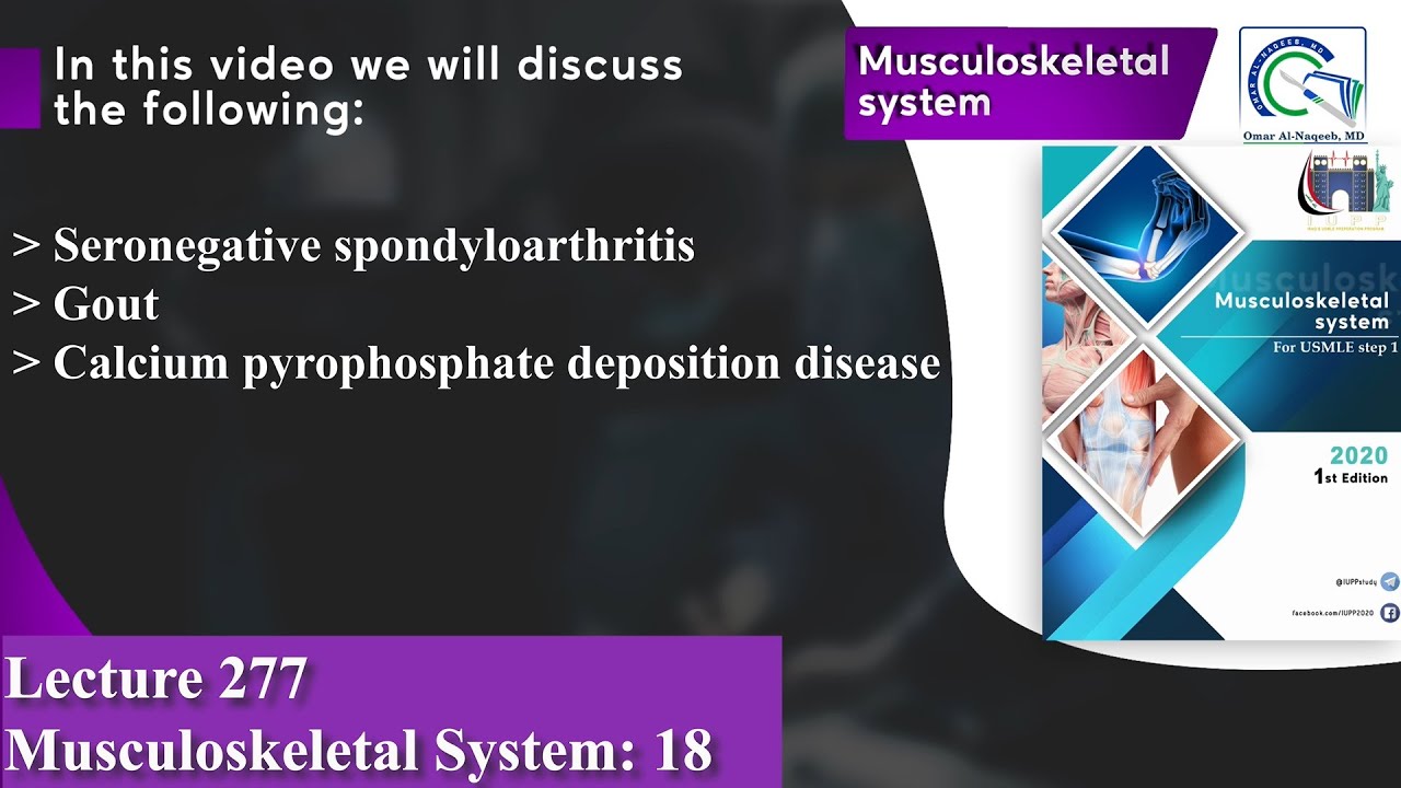 Seronegative spondyloarthritis | Gout | Calcium pyrophosphate deposition disease