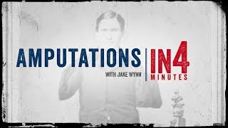 Amputations: The Civil War in Four Minutes