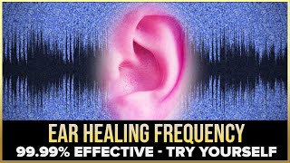 Cure All Ear Conditions : Ear Healing &amp; Treatment Binaural Beats Session | Healing Frequency #SG31