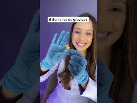 9 weeks pregnant, look at this life-size model of the fetus.