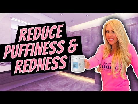 Reduce Puffiness, Rosacea & Redness #vitamink