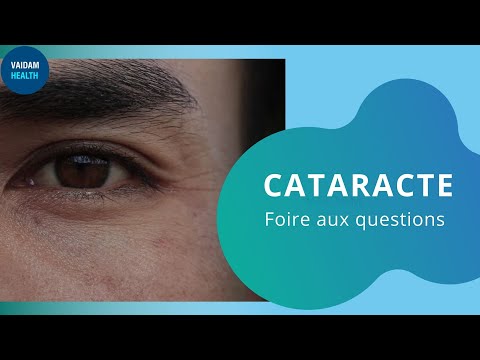 CATARACTE