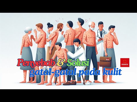 Thumbnail Video 2