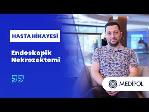 Endoskopik Nekrozektomi ile 22 cm’lik Pankreas Nekrozunun Tedavisi | Umut Bey’in Deneyimi