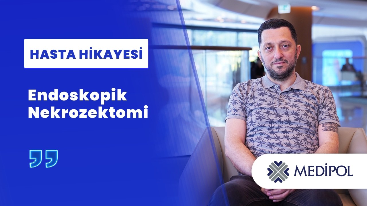 Endoskopik Nekrozektomi ile 22 cm’lik Pankreas Nekrozunun Tedavisi | Umut Bey’in Deneyimi