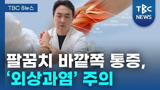 [TBC 닥터리포트] 팔꿈치 바깥쪽 통증, '외상과염' 주의
