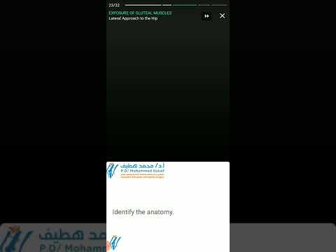 20 Steps Lateral Approach Hip In Total Hip Replacement - Easy Animation