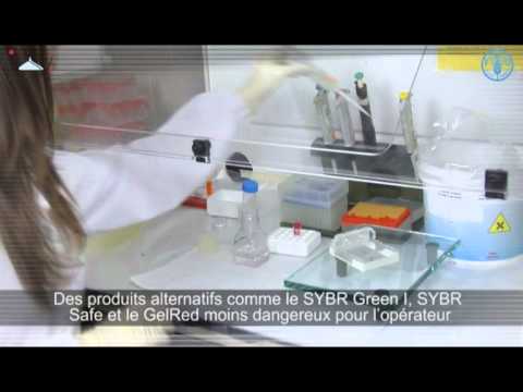 Visualization des resultants par électrophorèse en Gel d'Agarose