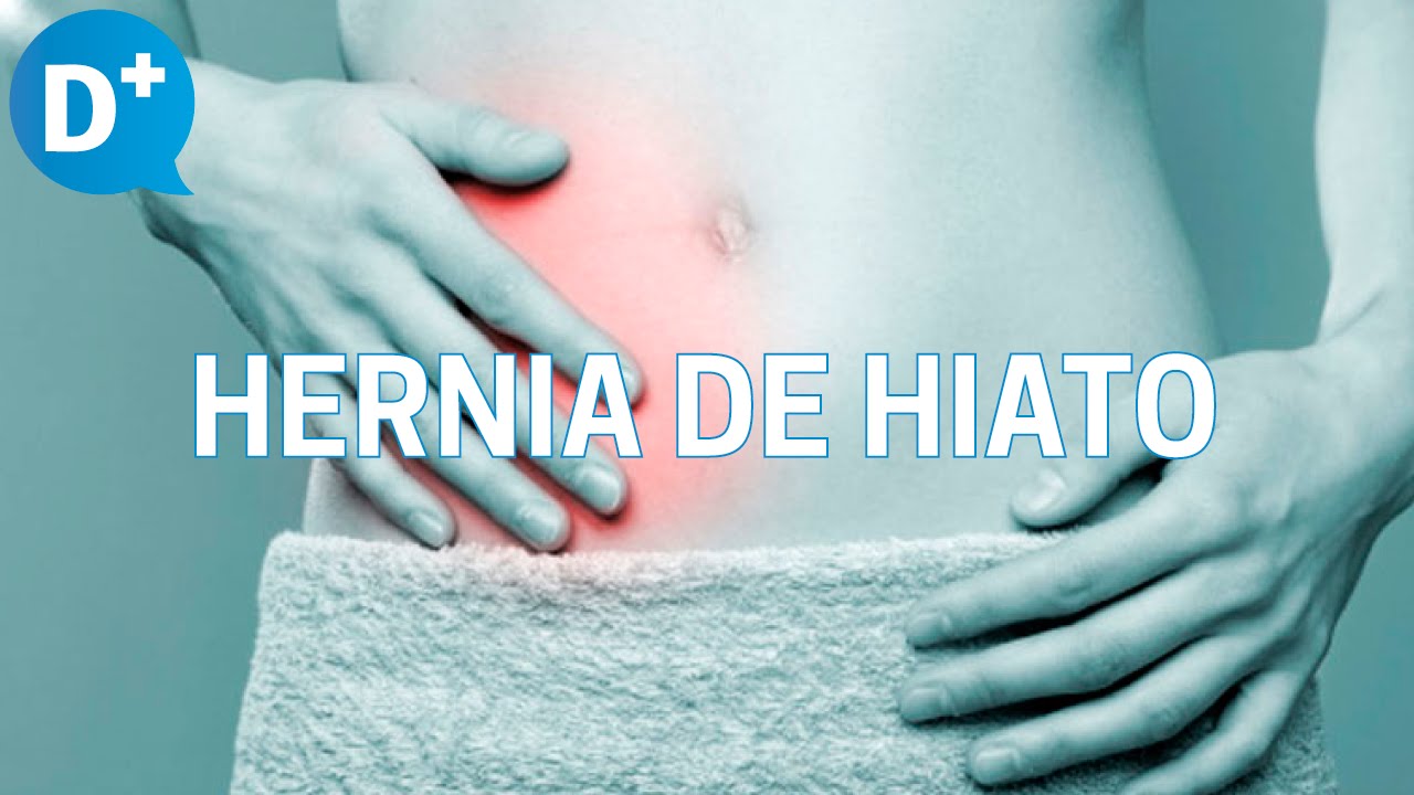 Hernia de hiato: Causas, síntomas y tratamiento de la hernia de hiato