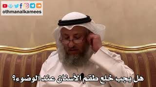 399 - هل يجب خلع طقم الأسنان عند الوضوء؟ - عثمان الخميس