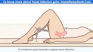 Yeast Infection -  Causes, Symptoms And Treatment Of Vaginal Yeast Infection