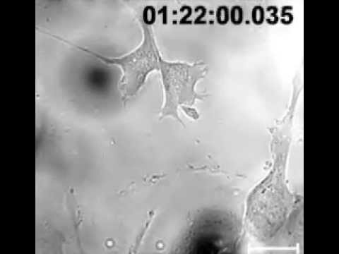 Lipid droplets as a novel cargo of tunnelling nanotubes in endothelial cells - YouTube