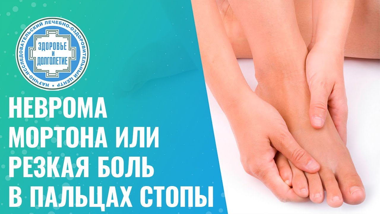 🔴​ Неврома Мортона или резкая боль в пальцах стопы