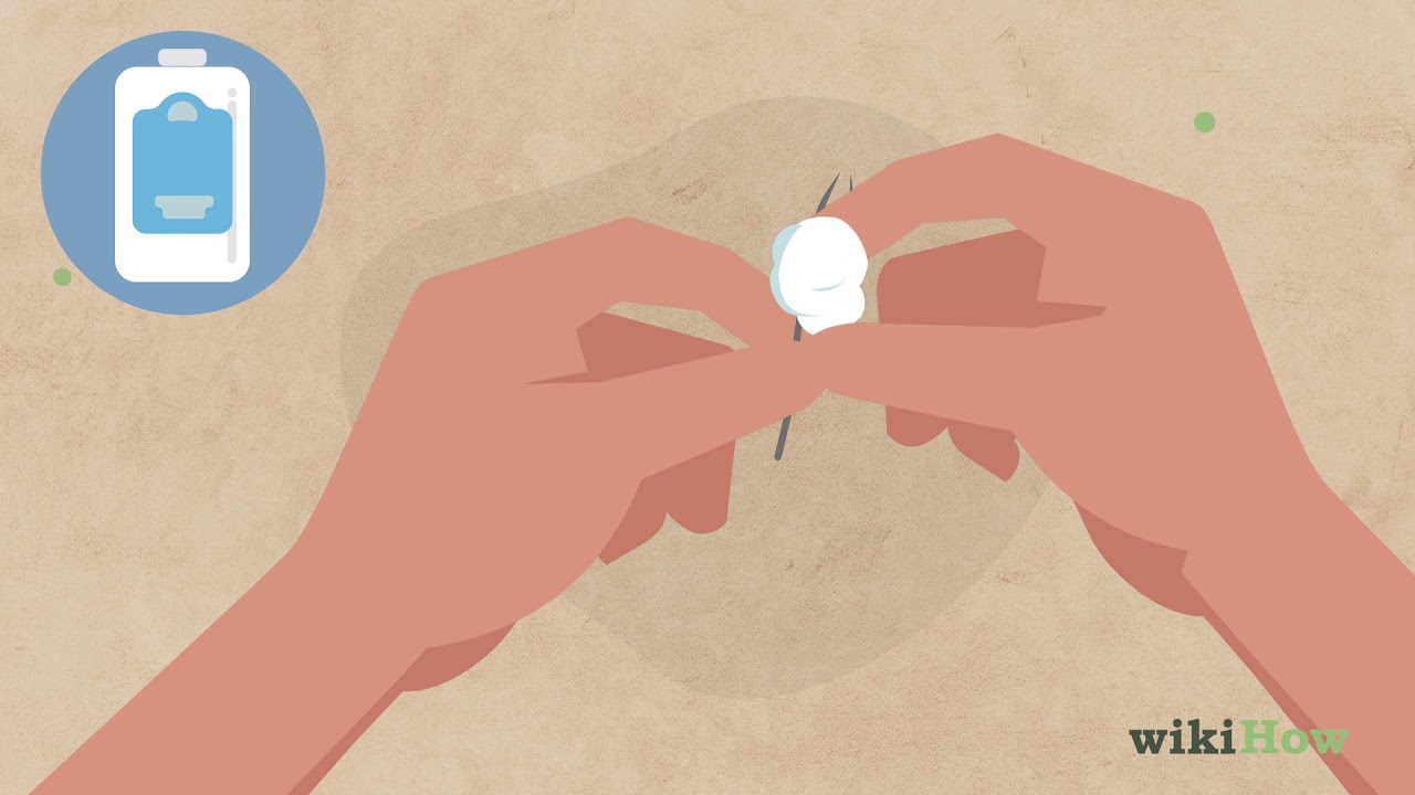 How to Remove a Deep Splinter