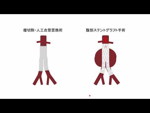 【山口大学OC2025／医学部／医学科】器官病態外科学講座紹介