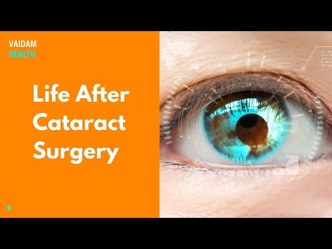 Life After Cataract Surgery
