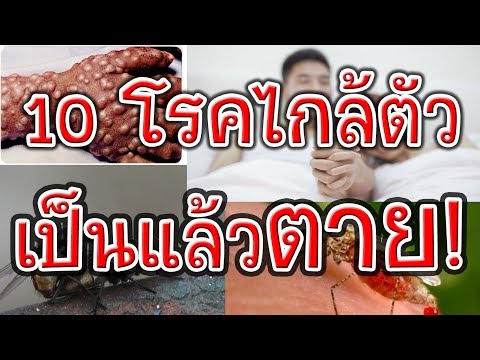 การรักษายาของความอ่อนแอ การรักษาความอ่อนแออิสราเอล