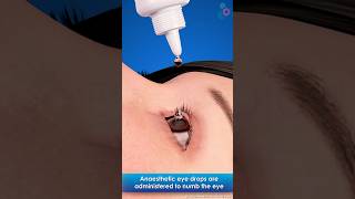 Laser Photocoagulation ↪ 3D Medical Animation #eyes #retinal #eyedisease