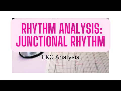 EKG Rhythm Analysis: Junctional rhythm