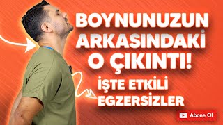 BOYNUMUN ARKASINDA BİR ÇIKINTI (DEVE HÖRGÜCÜ) VAR! ETKİLİ EGZERSİZLERİ ÖĞREN!
