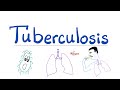 Tuberculosis (TB) [formerly Phthisis Pulmonalis] | Respiratory Pathology