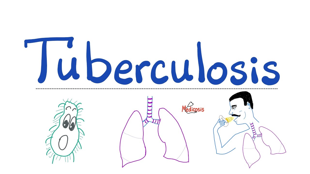 Tuberculosis (TB) - The Most Comprehensive Explanation - Respiratory Pathology - Pulmonology Series