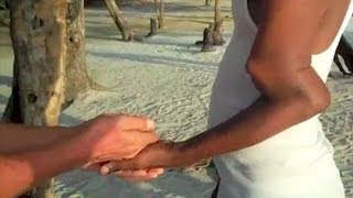 Incredible Broken Arm - You Have Been Warned