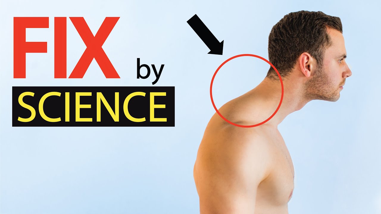 How to FIX Forward Head Posture - Proven by Science (22 studies) + Myth Busting!