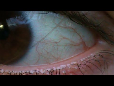 KYOTTO - Invierno (ft. SUSHIKING)