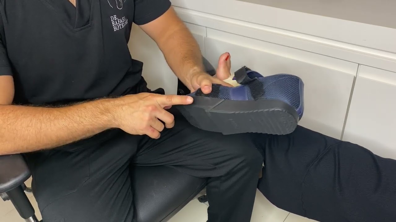 Como usar a Sandália Cunha Distal (Cunha-Antepé)