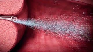 [閒聊] 看到授精過程的影片會害羞嗎?